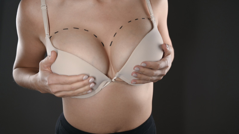 What is the Best Brand of Breast Implants?