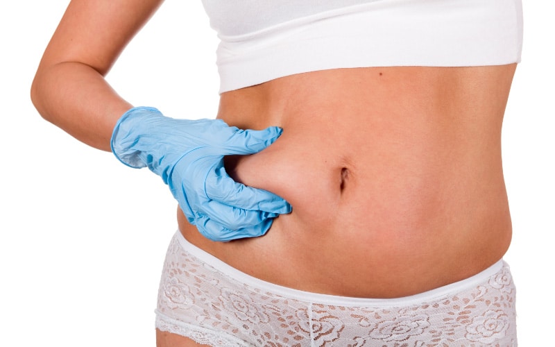 The Procedure For An Outpatient Liposuction Procedure Is