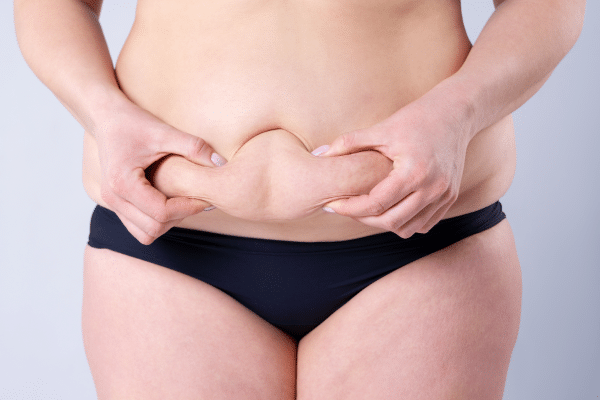 Questions To Ask Before Tummy Tuck