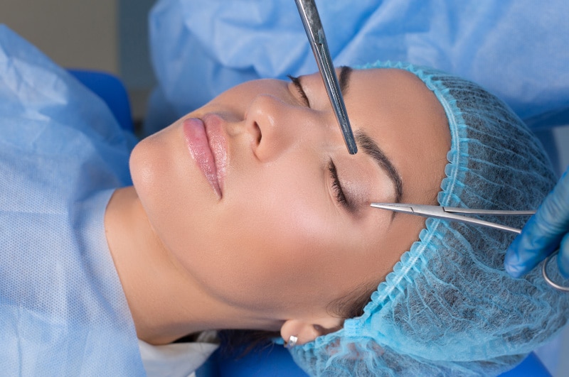 11 Things to know about Blepharoplasty