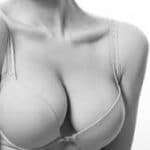 Breast Reduction Dallas