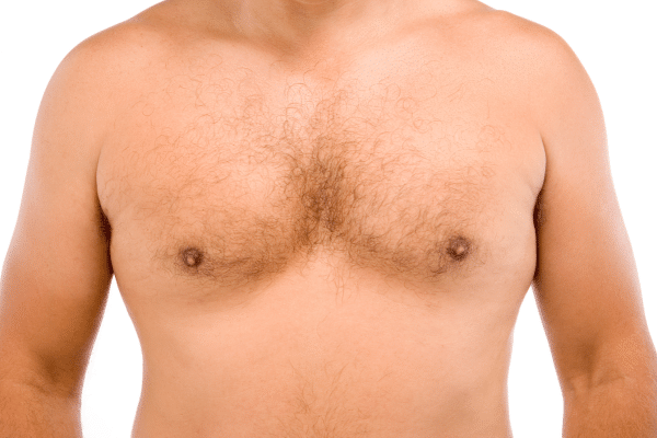 Bad Gynecomastia Surgery Before And After