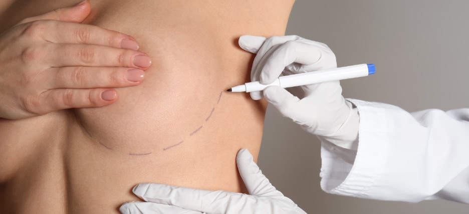 Breast Augmentation Scars