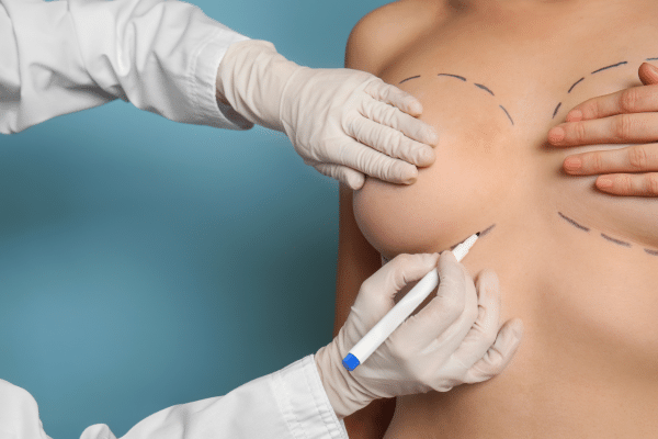 Breast Implant Incision Healing