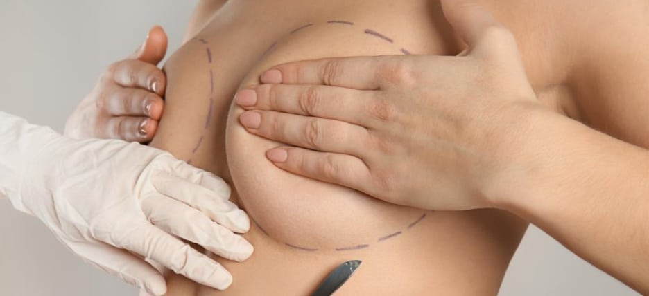Breast Implant Incision