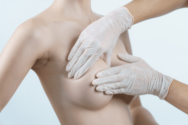 Breast Implant Revision Surgery Recovery