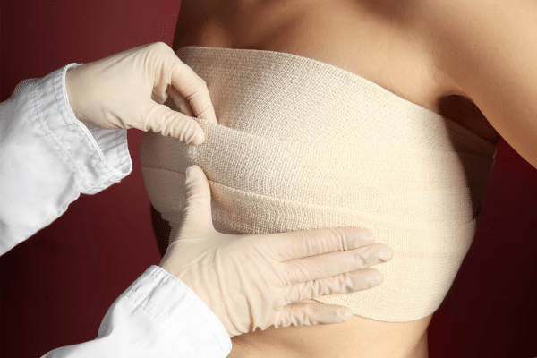 Breast Implants Recovery Timeline