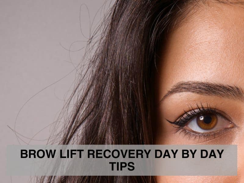 Brow Lift Recovery Day by Day Tips