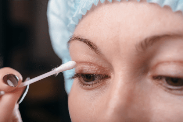Cost Of Eyelid Surgery