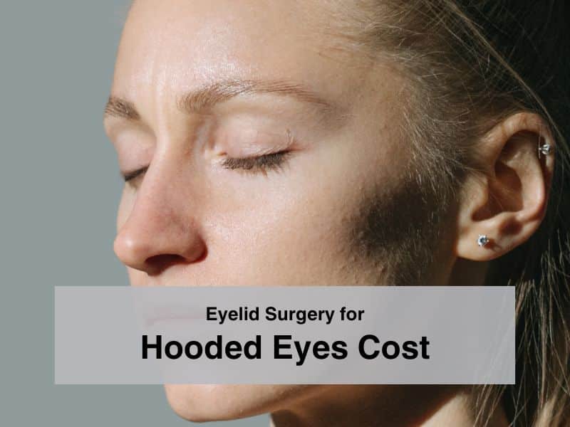 Eyelid Surgery for Hooded Eyes Cost