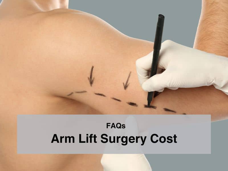 FAQs Arm Lift Surgery Cost