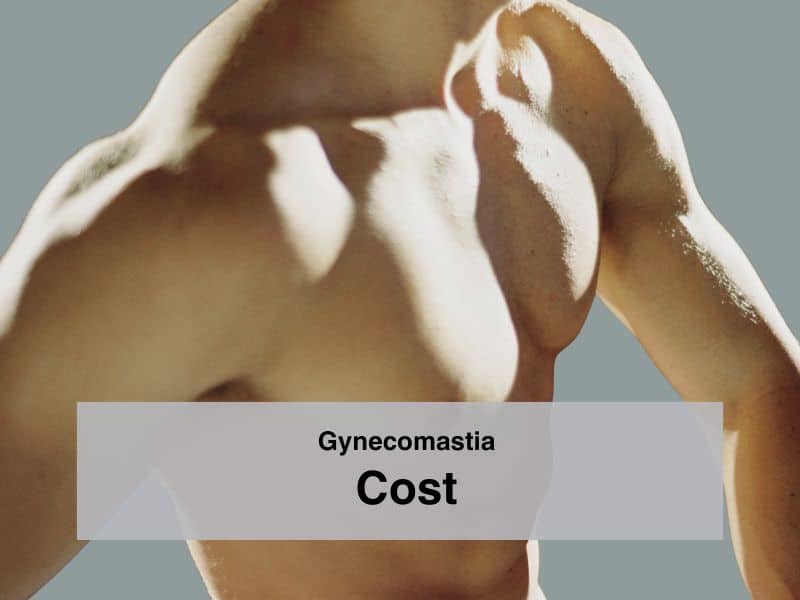 Gynecomastia Cost