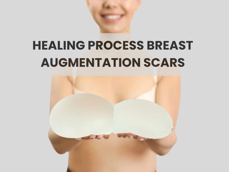 Healing Process Breast Augmentation Scars