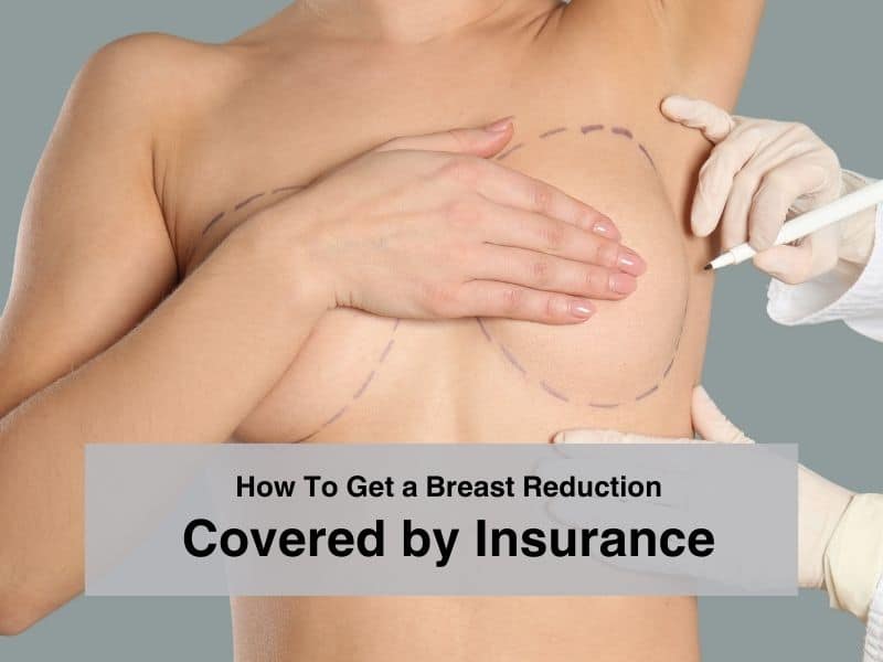 How To Get a Breast Reduction Covered by Insurance