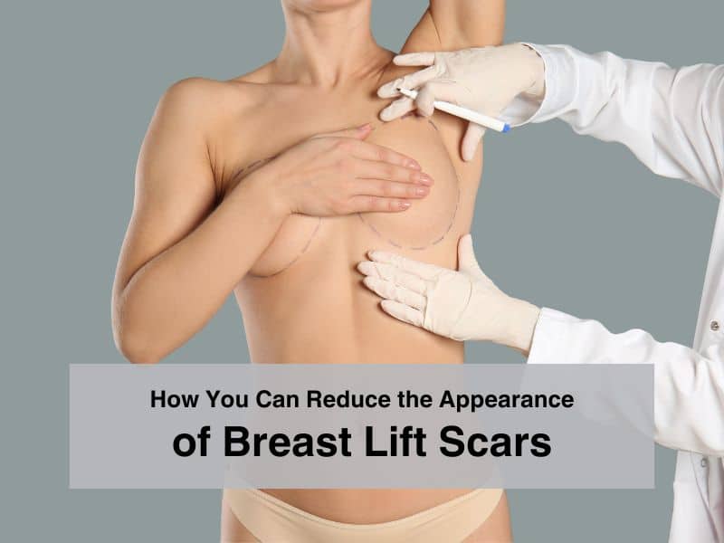 How You Can Reduce the Appearance of Breast Lift Scars
