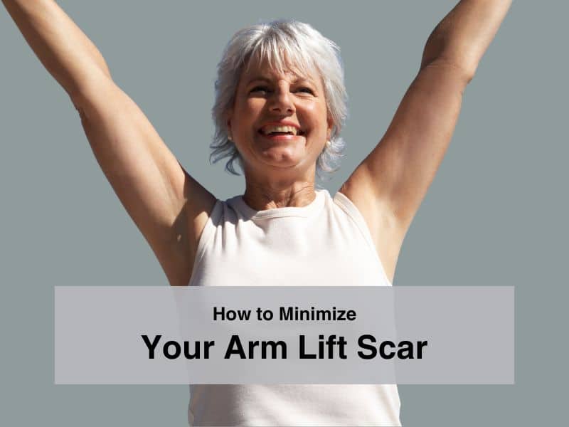 How to Minimize Your Arm Lift Scar