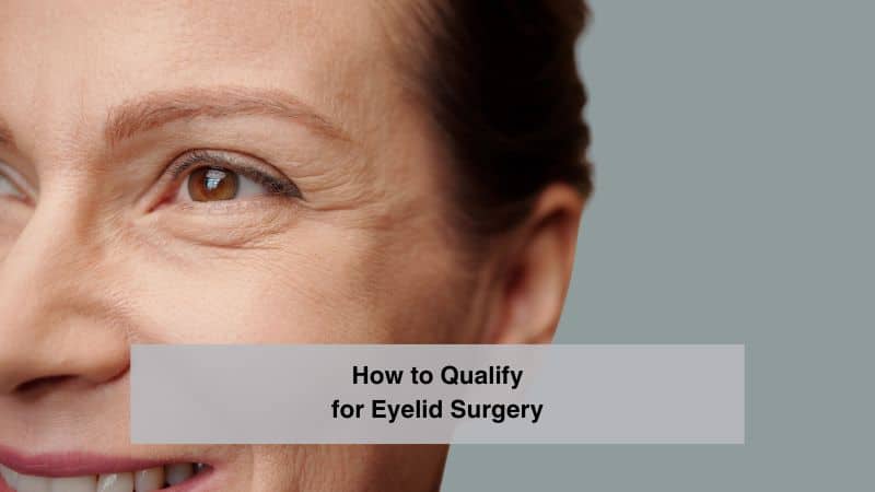 How To Qualify For Eyelid Surgery