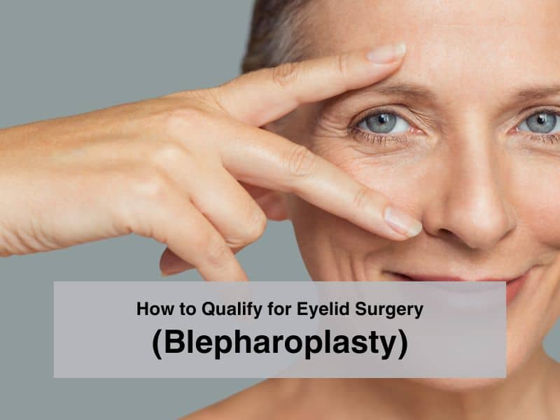How to Qualify for Eyelid Surgery (Blepharoplasty)