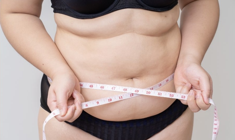 Lipo 360 Scars