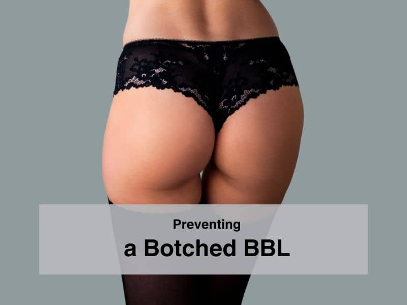 Preventing a Botched BBL