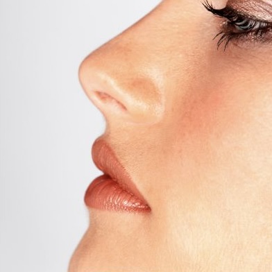 Rhinoplasty Revision Dallas