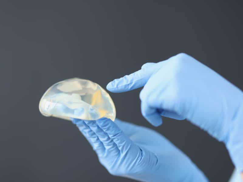 The Pros & Cons Of Breast Implant Revision Surgery