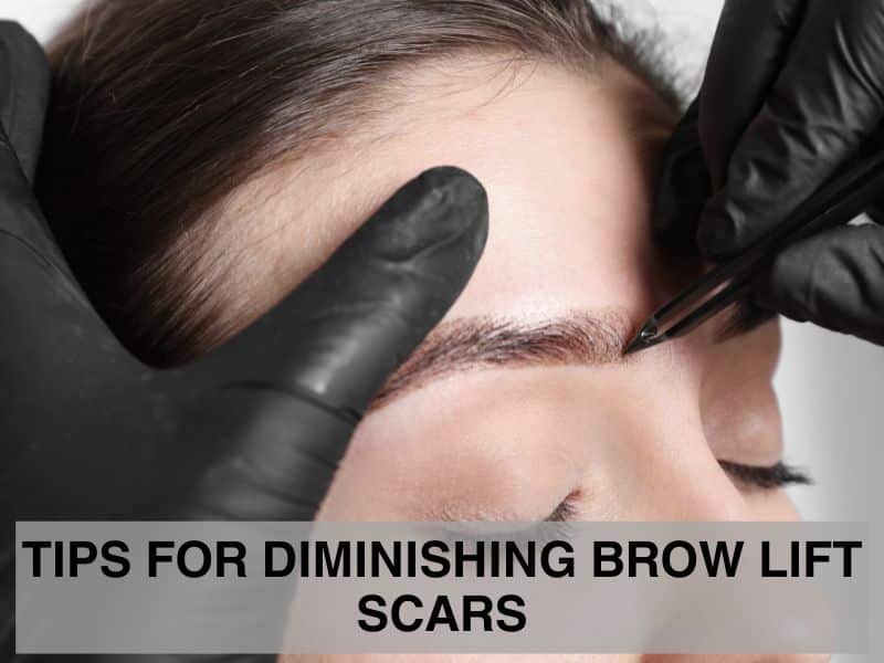 Tips for Diminishing Brow Lift Scars
