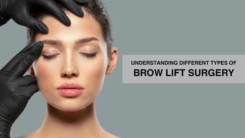 Understanding Different Types of Brow Lift Surgery