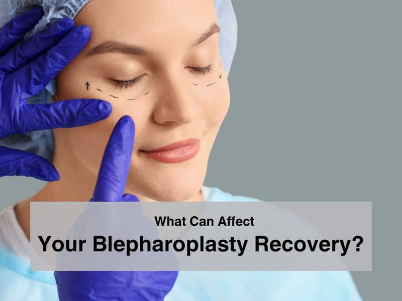 What Can Affect Your Blepharoplasty Recovery