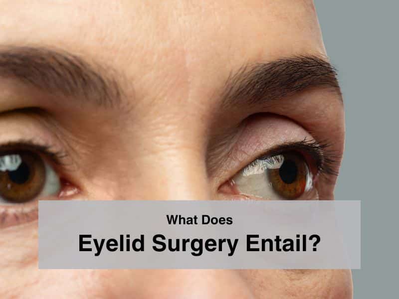 What Does Eyelid Surgery Entail
