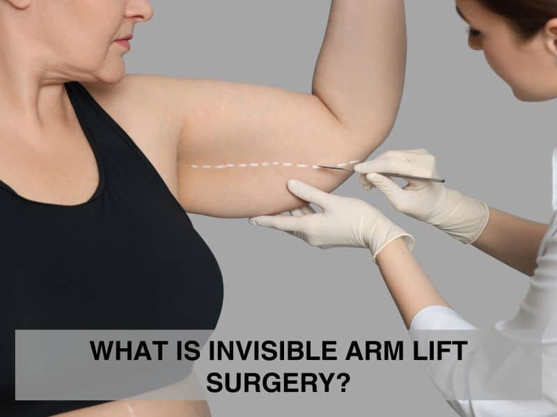 What Is Invisible Arm Lift Surgery