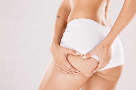 What is liposuction surgery