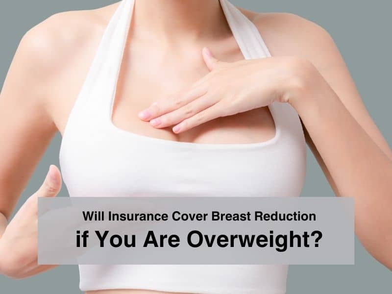 Will Insurance Cover Breast Reduction if You Are Overweight