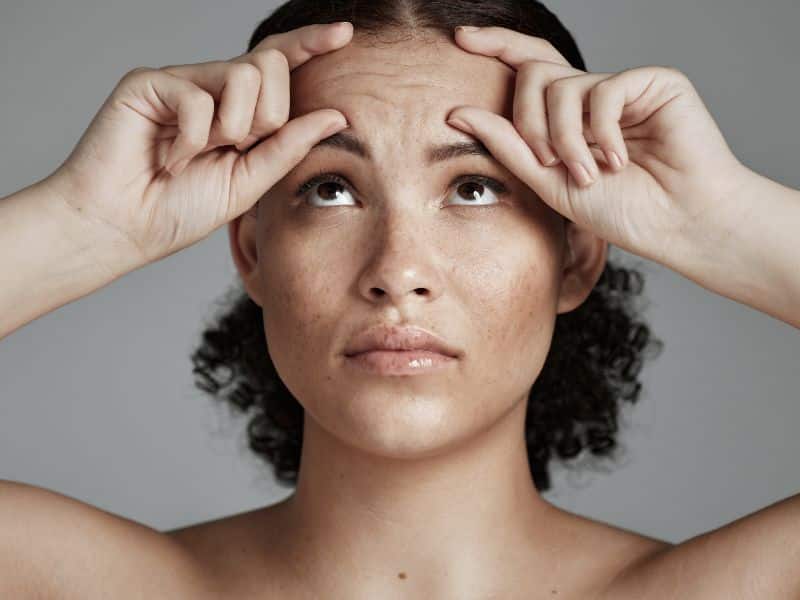 brow lift surgery