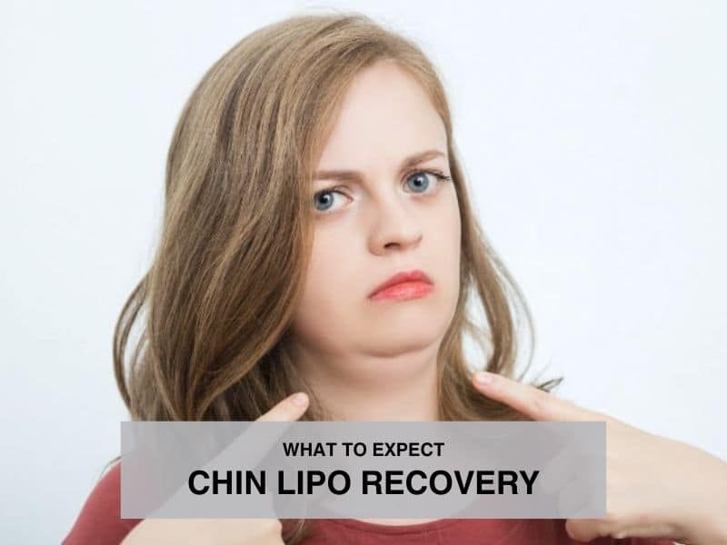 chin lipo recovery