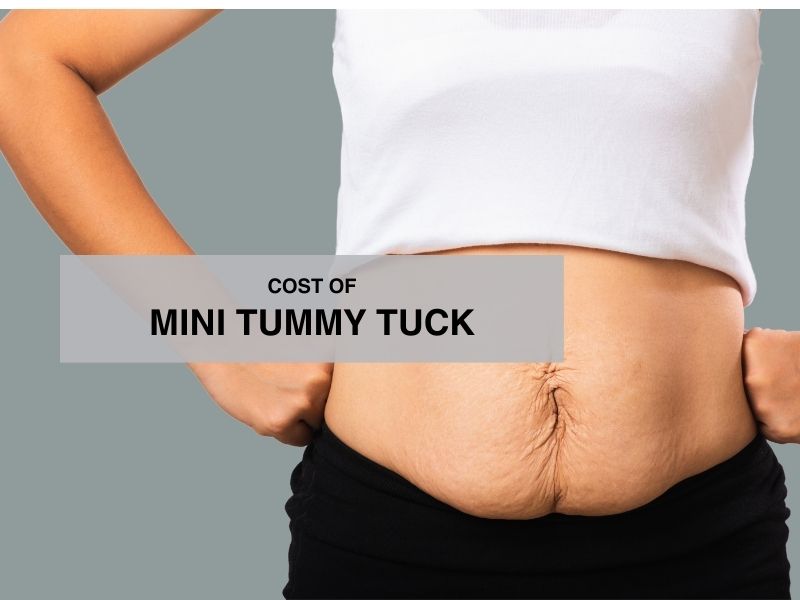 cost of mini tummy tuck