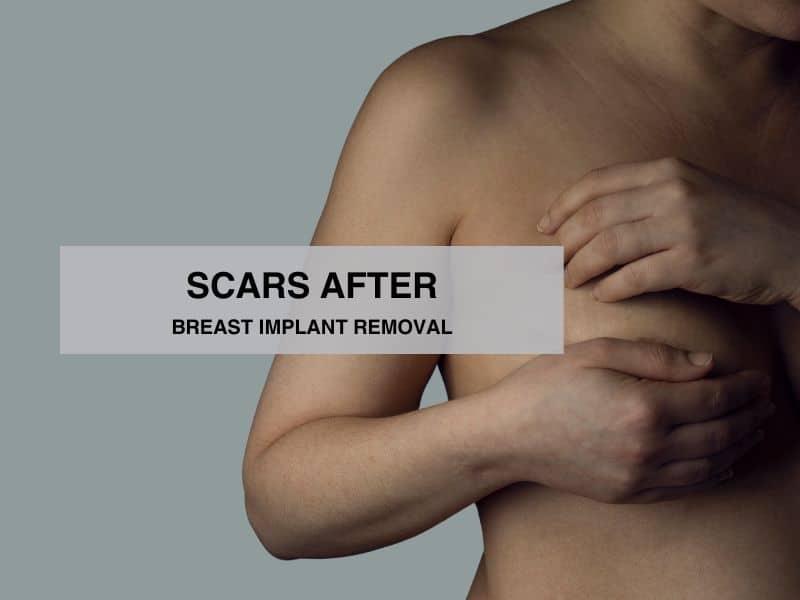 scars after breast implant removal