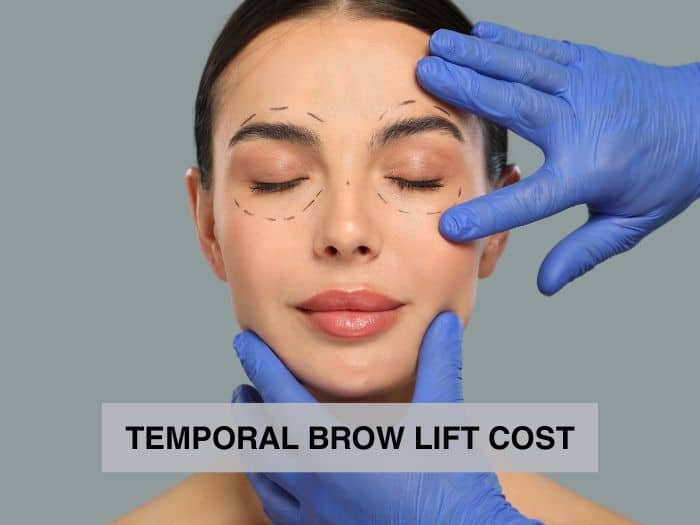 temporal brow lift cost